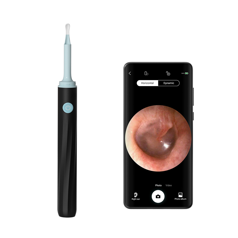 AiSee Pro FindB Wifi Ear Otoscope