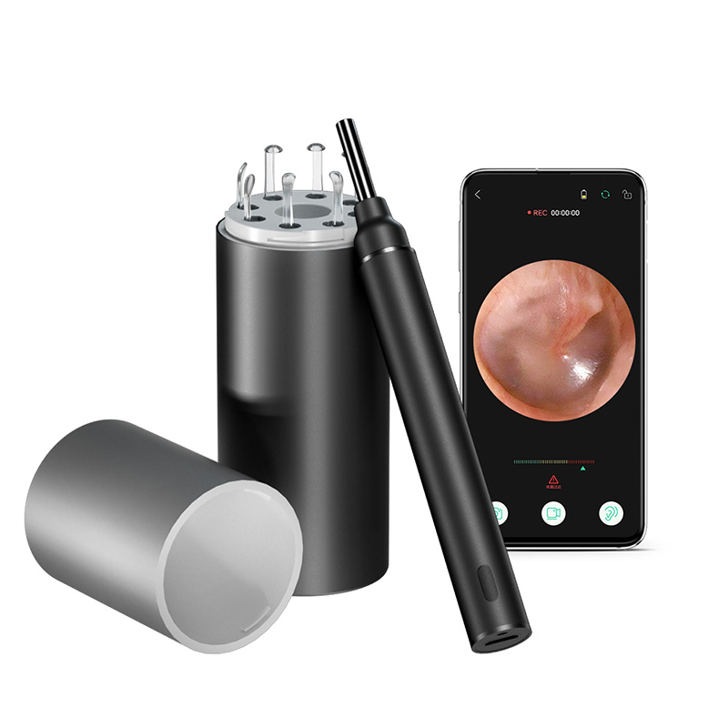 Ear Otoscope: A "Small Window" to Explore the Ear Canal  